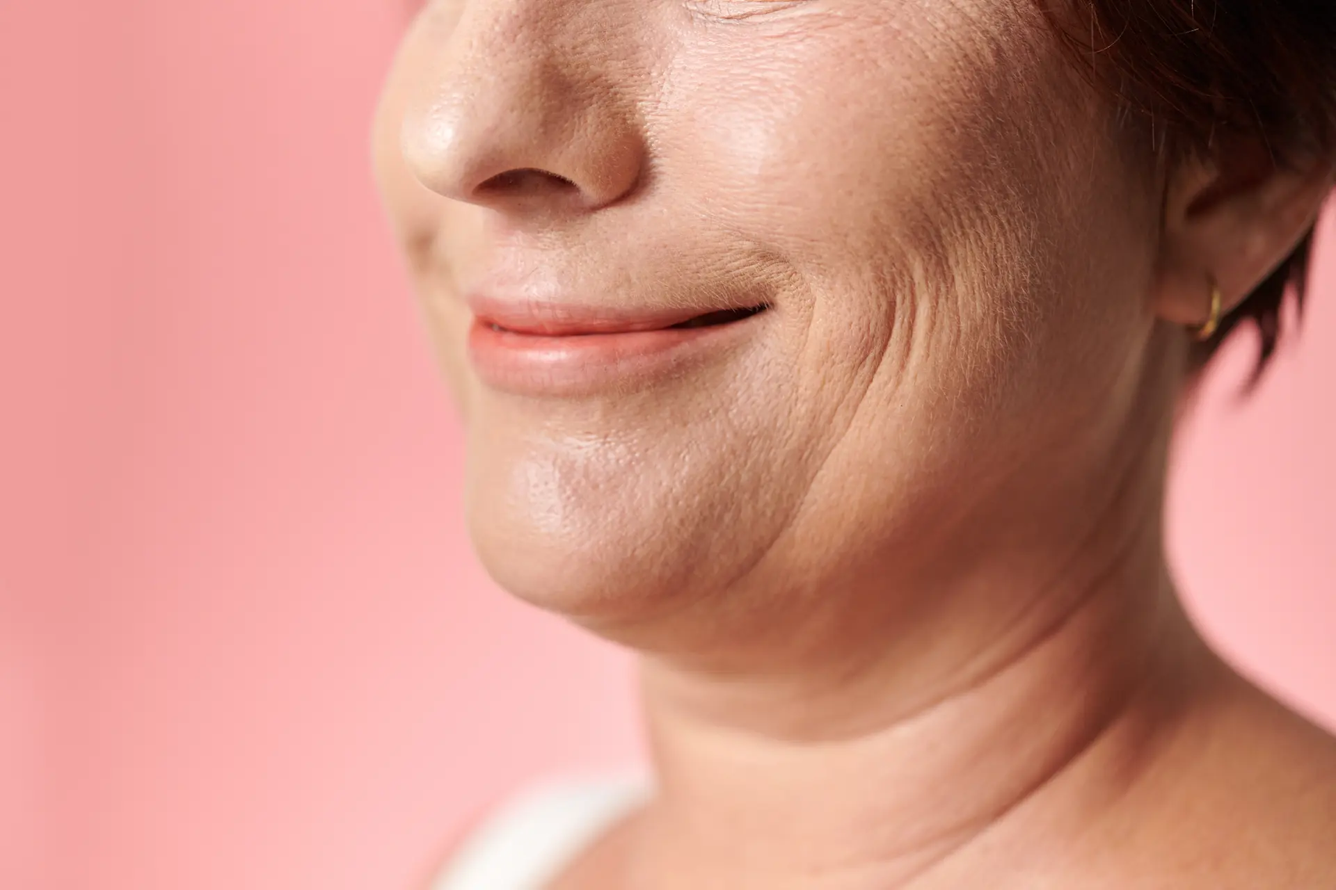 Jowl lifting and jawline definition treatments at 99 Medispa Sydney
